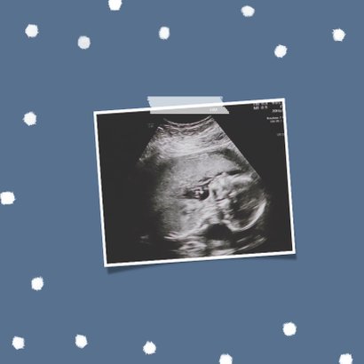 Mommy to be moederdag zwanger baby 2
